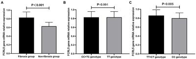 Fc receptor-like 5 gene polymorphisms and mRNA expression are associated with liver fibrosis in chronic hepatitis B